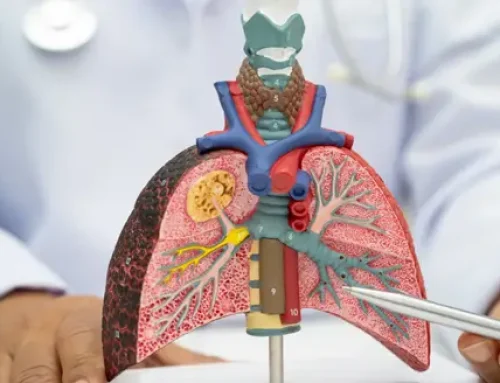 Take the Next Step Toward Better Lung and Sleep Health