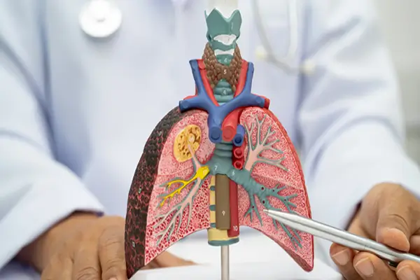 Pulmonary and Sleep Conditions