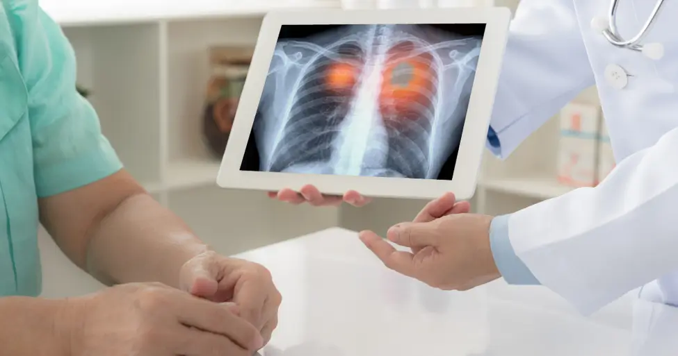 Importance of Lung Cancer Screening